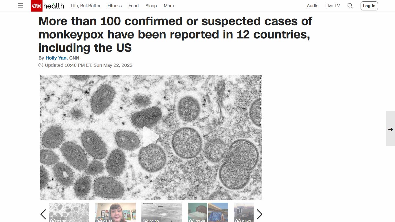 More than 100 confirmed or suspected cases of monkeypox have been ... - CNN